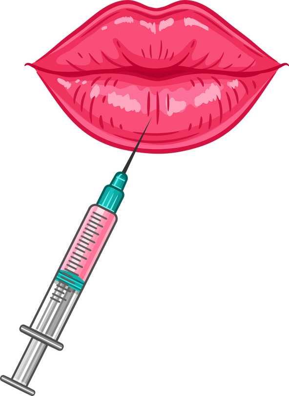 Lip Augmentation Procedure Illustration 